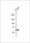 NOTCH4 Antibody (C-term)