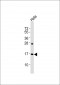 p16-INK4A(S152) Antibody