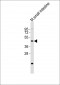 LMX1A Antibody (C-term)