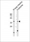 MC3R Antibody (C-term)