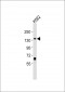 SYNJ1 Antibody (C-term)