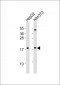 HMGA2 Antibody (C-term)