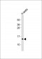 PCP2 Antibody (Center)
