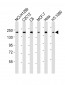 ROCK2 Antibody (C-term)