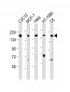 ROCK2 Antibody (C-term)