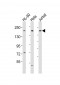 DIP2A Antibody (Center)