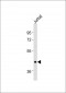 OXTR Antibody (C-term)