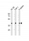 FCGR1A Antibody (Center)