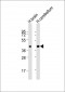 SH3GL2 Antibody (Center)