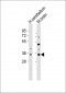 CDK5R1 Antibody (N-term)