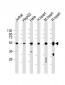 OXCT1 Antibody (Center)