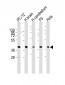 SH3GL2 Antibody (C-term)