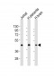 WNT2 Antibody (Center)