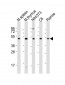 Mouse Csk Antibody (C-term)