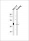 (Mouse) Bmi1 Antibody (Center)