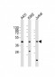 RBMX Antibody (Center)