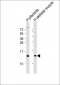 KISS1 Antibody (N-Term)