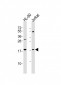 KISS1 Antibody (N-Term)