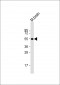 GABRA1 Antibody (C-term)