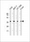 ACBD4 Antibody (Center)