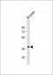 RASSF2 Antibody (N-Term)