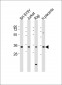 RASSF2 Antibody (Center)