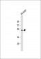 UGT2B4 Antibody (C-term)