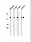 PGM1 Antibody (C-Term)