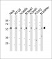 ETV1 Antibody (C-Term)