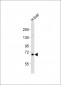 IDUA Antibody (Center)