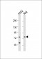 ABCB10 Antibody (N-term)