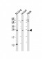 SOST Antibody (N-term)