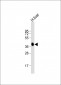 AGXT Antibody (Center)