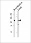 GLUL Antibody (N-term)