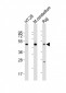 GLUL Antibody (N-term)