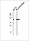 GLUL Antibody (N-term)