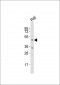 GLUL Antibody (N-term)