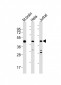 GLUL Antibody (N-term)