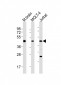 GLUL Antibody (N-term)