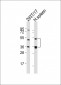 LAG3 Antibody (Center)