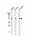 LAG3 Antibody (Center)