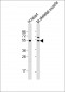 PDK4 Antibody (C-term)