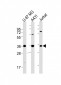 MICA Antibody (Center)