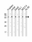 IL2RG Antibody (N-term)