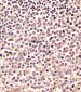 PSMB9 Antibody (C-term)