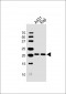 PSMB9 Antibody (C-term)