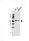 APRT Antibody (N-term)