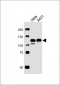 GTF2I Antibody (C-term)