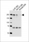 ROS1 Antibody (C-term)