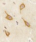 PIP4K2A Antibody (C-term)